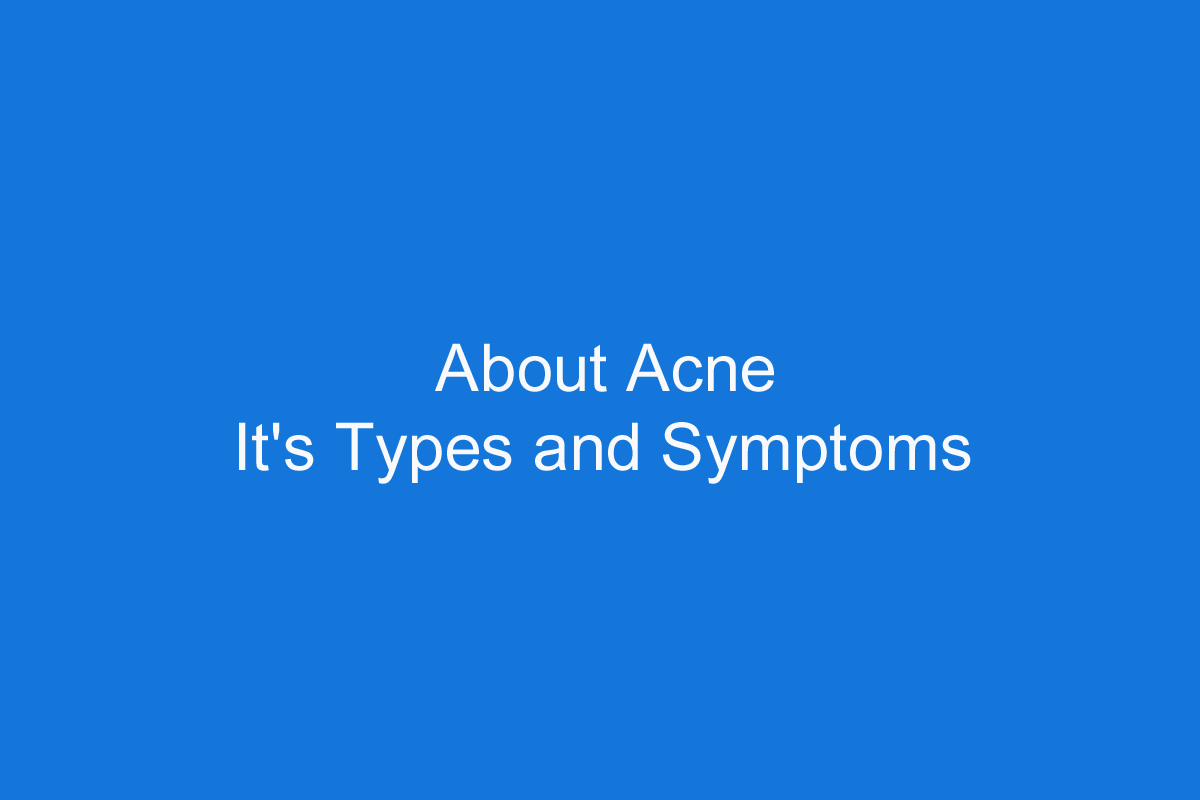 About Acne, It’s Types and Symptoms