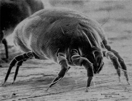 Dust Mites in The Home