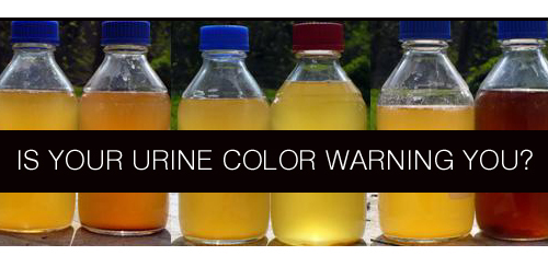 Is Your Urine Color Warning You?