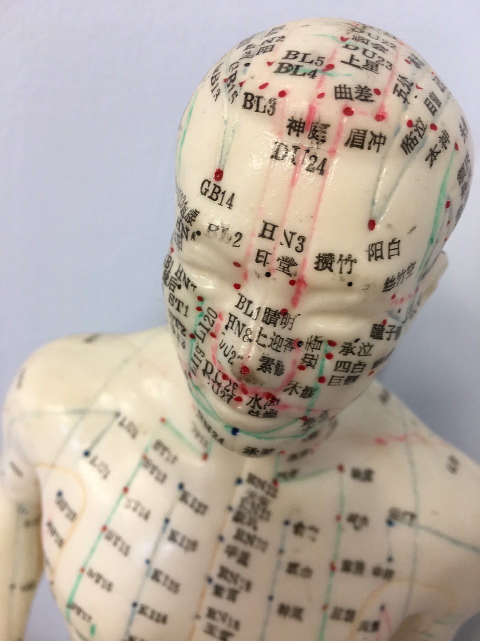 The Different Types of Acupuncture