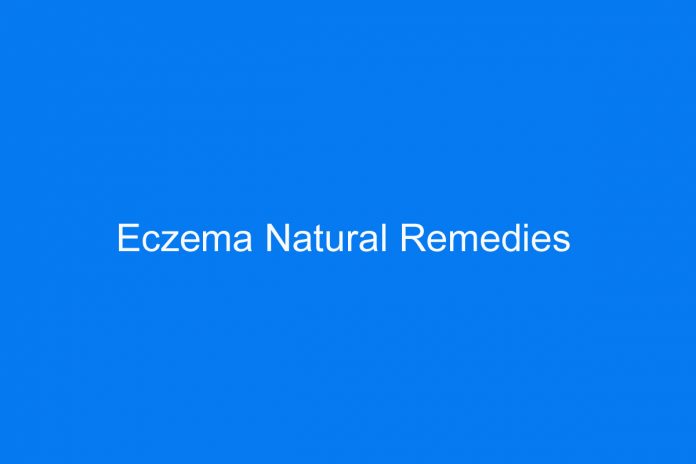 Eczema Natural Remedies