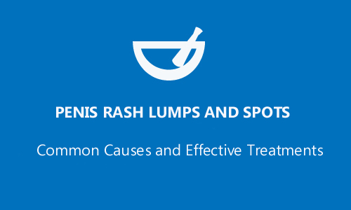 Penis Rash Lumps and Spots - Common Causes and Effective Treatments