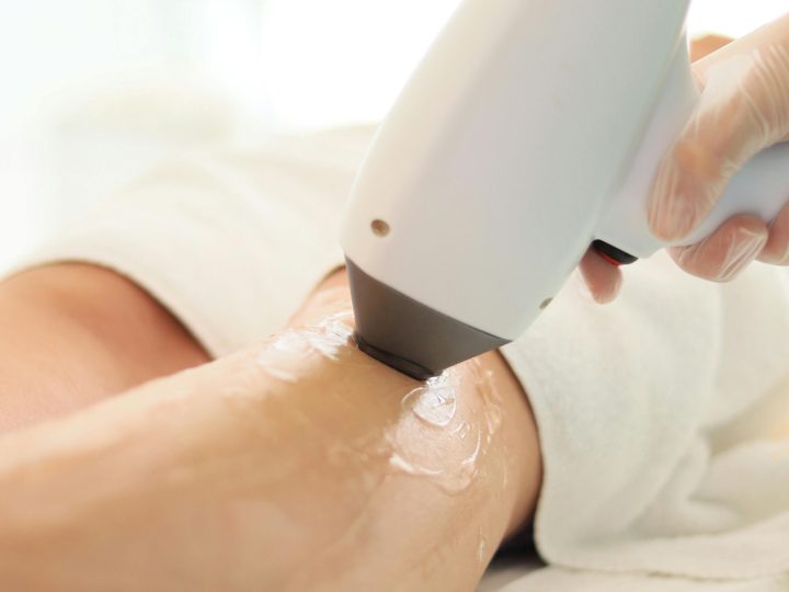 The Science and Benefits of Laser Hair Removal