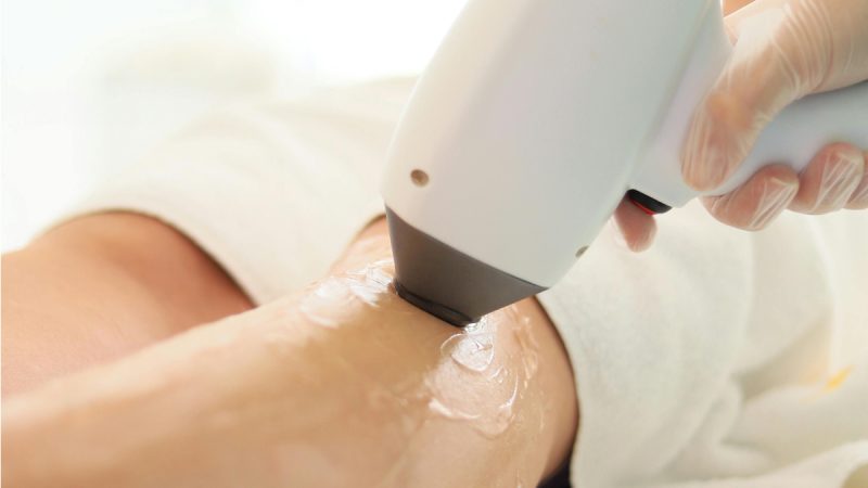 The Science and Benefits of Laser Hair Removal