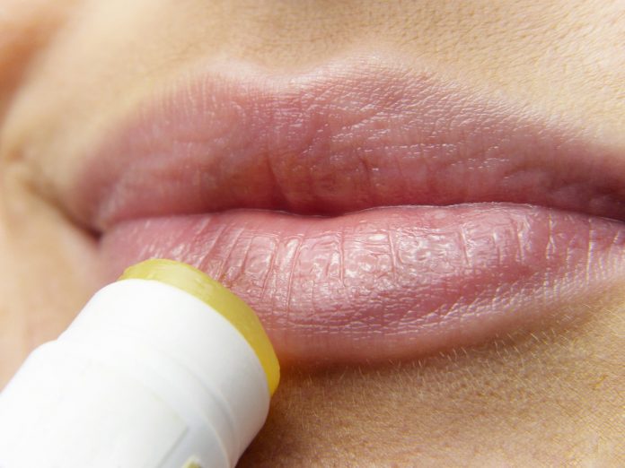 How to Treat Chapped and Dry Lips The Natural Way
