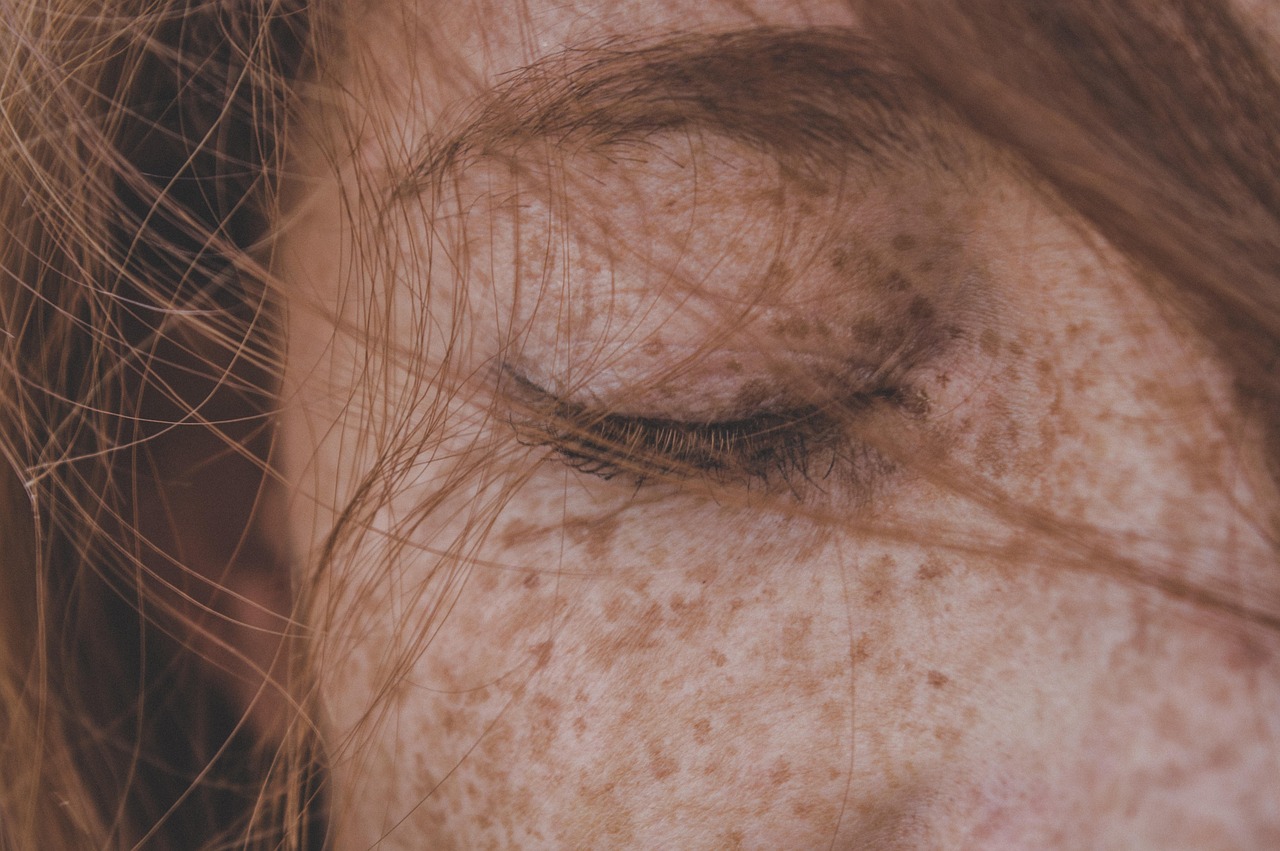 Reduce Freckles in The Kitchen